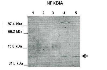 NFKBIA Rabbit Polyclonal Antibody