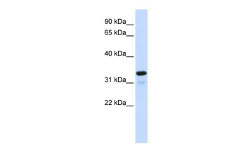 NFKBIA Rabbit Polyclonal Antibody
