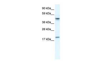 PDCD4 Rabbit Polyclonal Antibody
