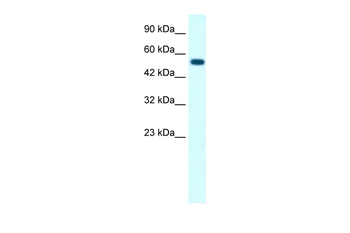 GLRA1 Rabbit Polyclonal Antibody