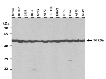 CHRNA7 Rabbit Polyclonal Antibody
