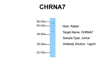 CHRNA7 Rabbit Polyclonal Antibody