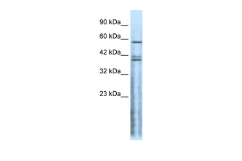 CHRND Rabbit Polyclonal Antibody