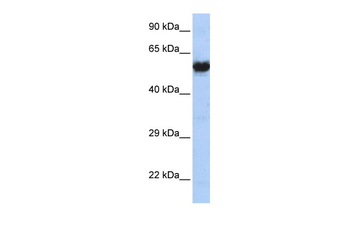 CHRNG Rabbit Polyclonal Antibody
