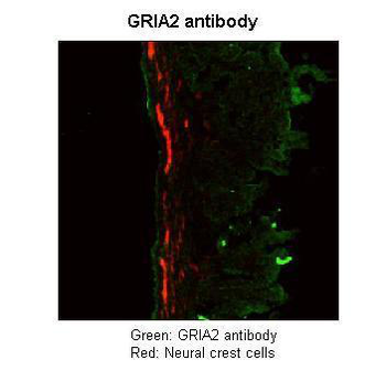 GRIA2 Rabbit Polyclonal Antibody