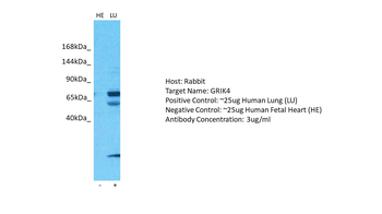 GRIK4 Rabbit Polyclonal Antibody