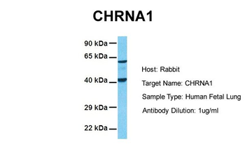 CHRNA1 Rabbit Polyclonal Antibody