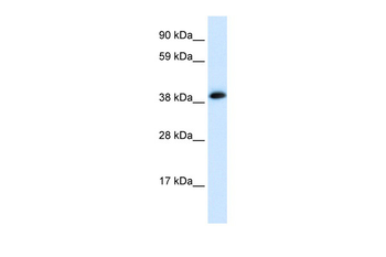 CHRNA1 Rabbit Polyclonal Antibody