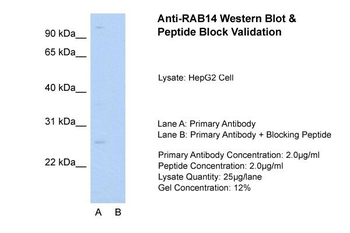 RAB14 Rabbit Polyclonal Antibody