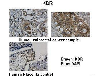KDR Rabbit Polyclonal Antibody