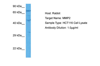 MMP2 Rabbit Polyclonal Antibody