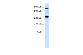 SERPINF1 Rabbit Polyclonal Antibody