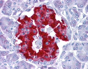 PRDM1 Rabbit Polyclonal Antibody