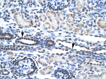 ETS1 Rabbit Polyclonal Antibody