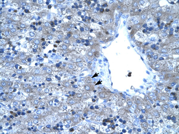 TAL1 Rabbit Polyclonal Antibody
