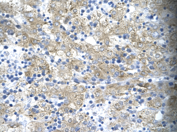 TAL1 Rabbit Polyclonal Antibody