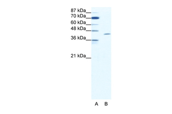 TAL1 Rabbit Polyclonal Antibody