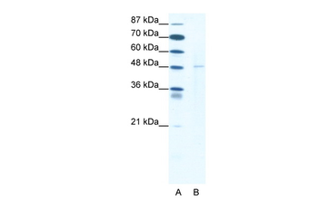 DEK Rabbit Polyclonal Antibody