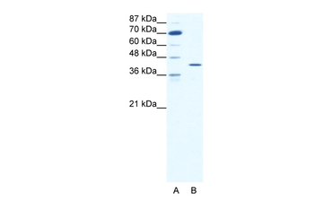 FOS Rabbit Polyclonal Antibody