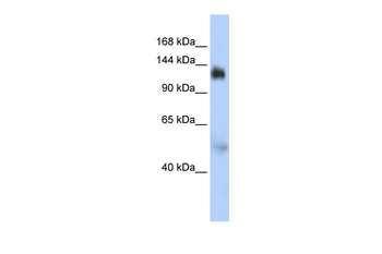 NFX1 Rabbit Polyclonal Antibody