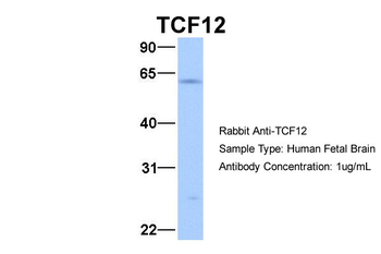 TCF12 Rabbit Polyclonal Antibody