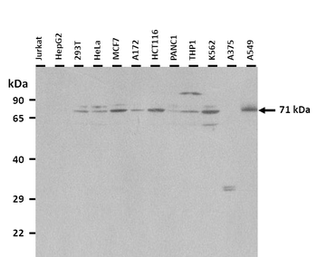 TCF4 Rabbit Polyclonal Antibody