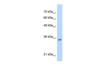 TCF4 Rabbit Polyclonal Antibody