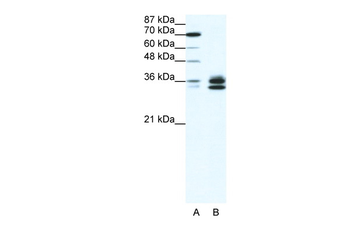 RELA Rabbit Polyclonal Antibody
