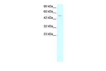 GTF2H1 Rabbit Polyclonal Antibody