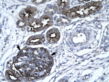 GABPA Rabbit Polyclonal Antibody