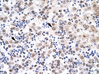 IRF8 Rabbit Polyclonal Antibody