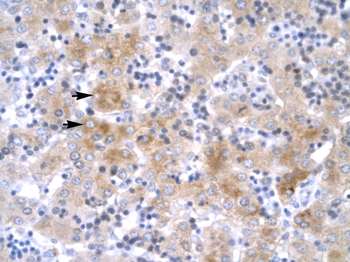LHX1 Rabbit Polyclonal Antibody