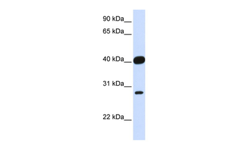 ELK3 Rabbit Polyclonal Antibody