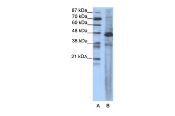 SRF Rabbit Polyclonal Antibody