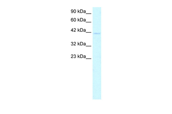 CEBPA Rabbit Polyclonal Antibody