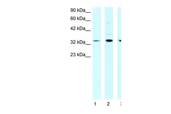 CSDA Rabbit Polyclonal Antibody