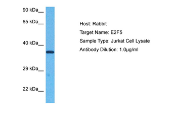 E2F5 Rabbit Polyclonal Antibody