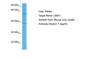 GTF2H1 Rabbit Polyclonal Antibody