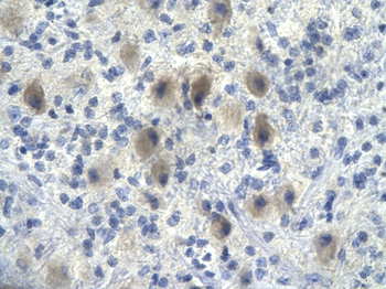 NFKBIA Rabbit Polyclonal Antibody