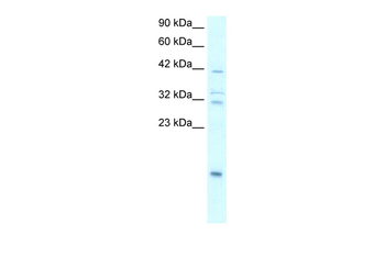 NFKBIA Rabbit Polyclonal Antibody