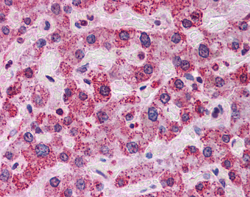 ENO1 Rabbit Polyclonal Antibody