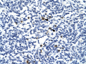 TAL1 Rabbit Polyclonal Antibody