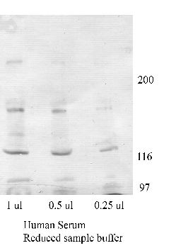 Anti-MYOC Rabbit Polyclonal Antibody