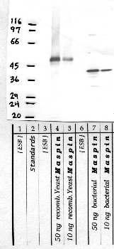 Anti-SerpinB5 Rabbit Polyclonal Antibody