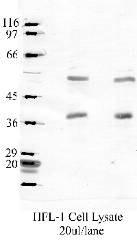 Anti-SerpinB3 Rabbit Polyclonal Antibody