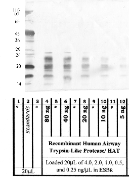 Anti-TMPRSS11D Rabbit Polyclonal Antibody