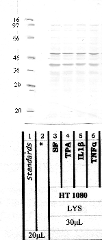 Anti-TMPRSS11D Rabbit Polyclonal Antibody