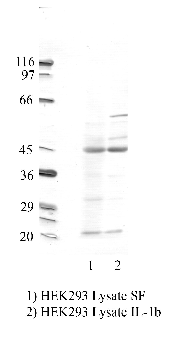 Anti-TMPRSS3 Rabbit Polyclonal Antibody