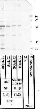 Anti-PREP Rabbit Polyclonal Antibody