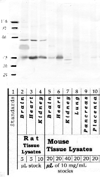 Anti-PCKS5 Rabbit Polyclonal Antibody